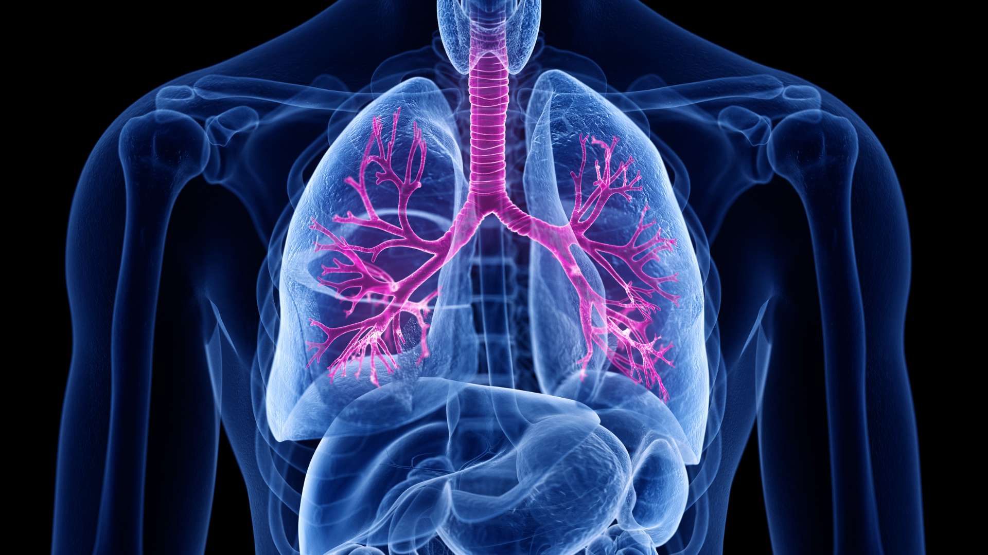 Chronic Bronchitis