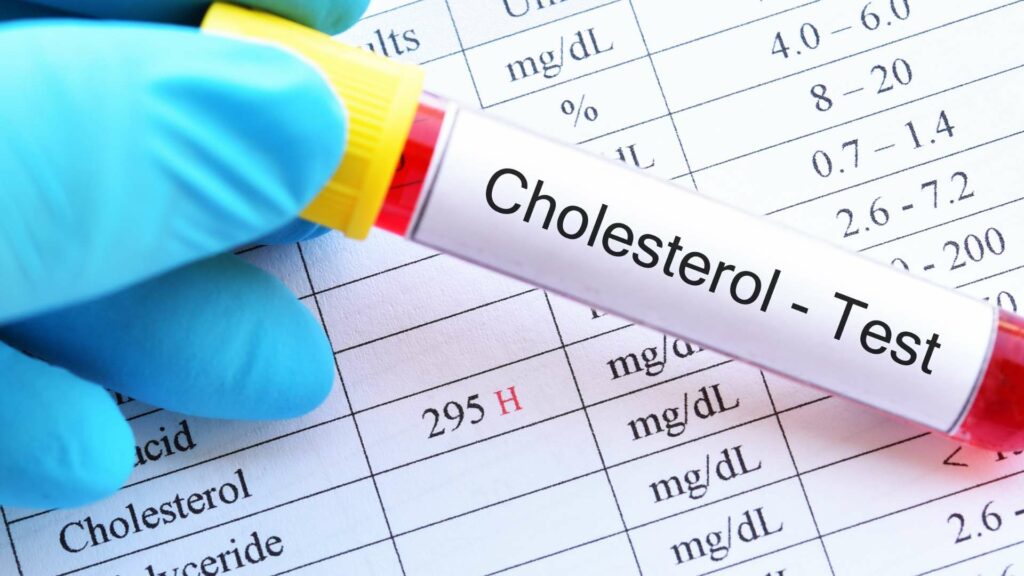 high cholesterol