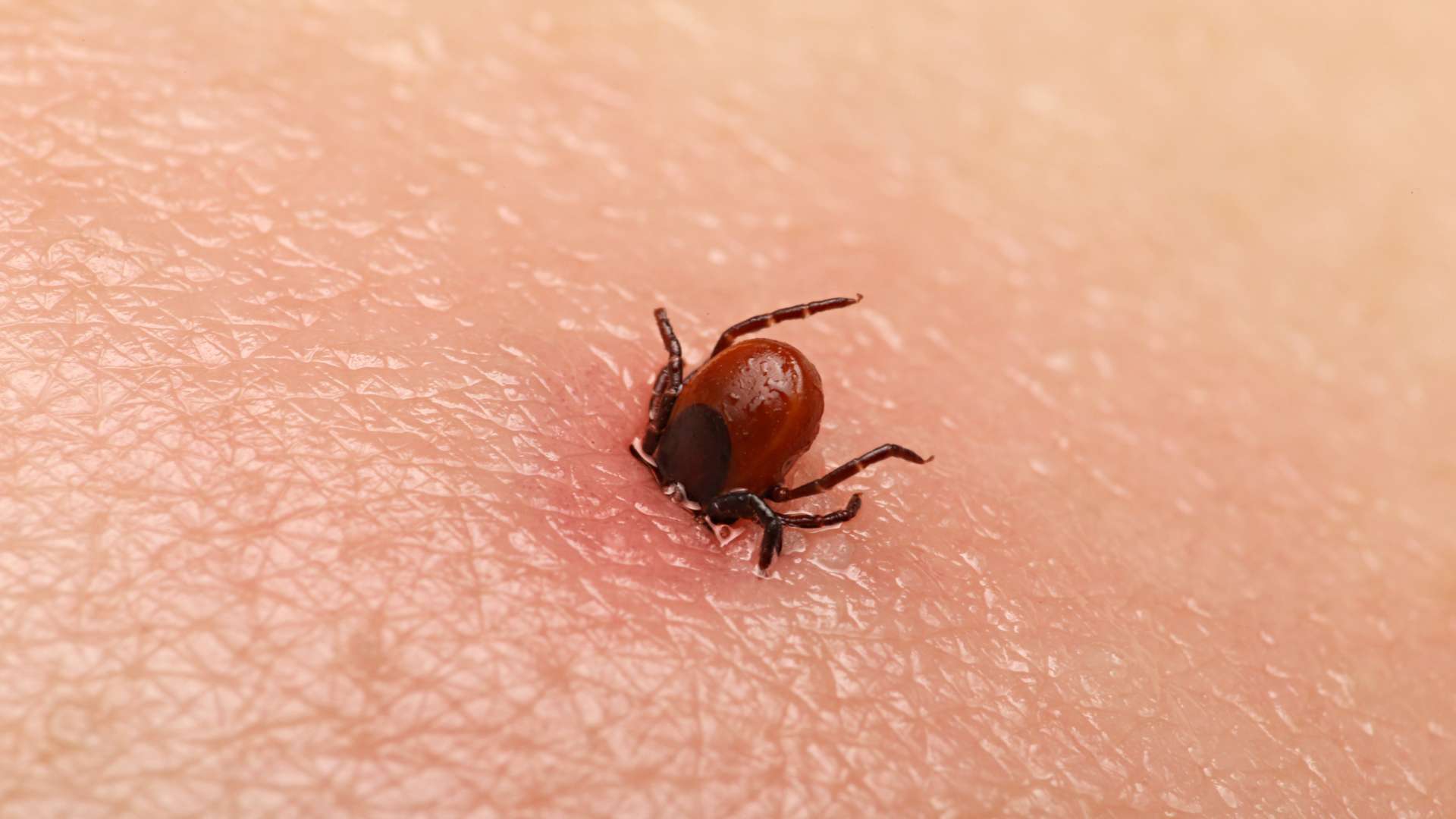 Tick/Insect Bites & Stings